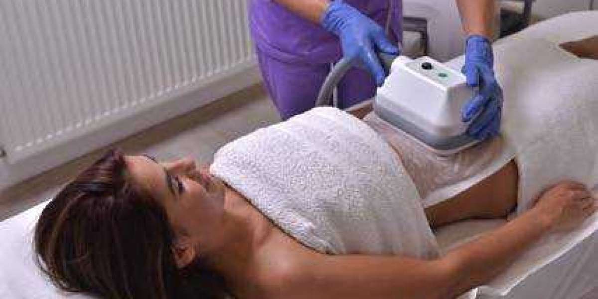 Beverly Hills Coolsculpting