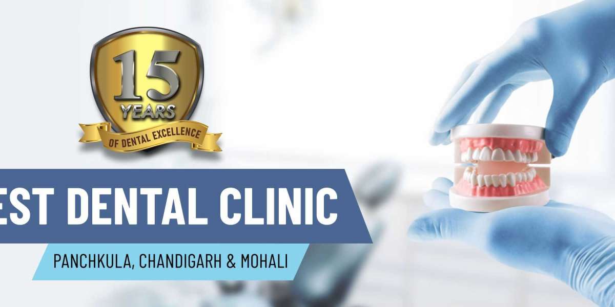Implant Dentist in Chandigarh  -  Dr.Dang 