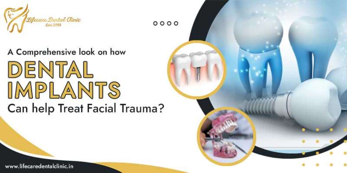 A Comprehensive Look On How Dental Implants Can Help Treat Facial Trauma?